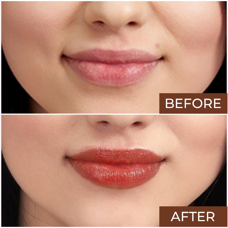 Elitty Lip Balm (6 gm)