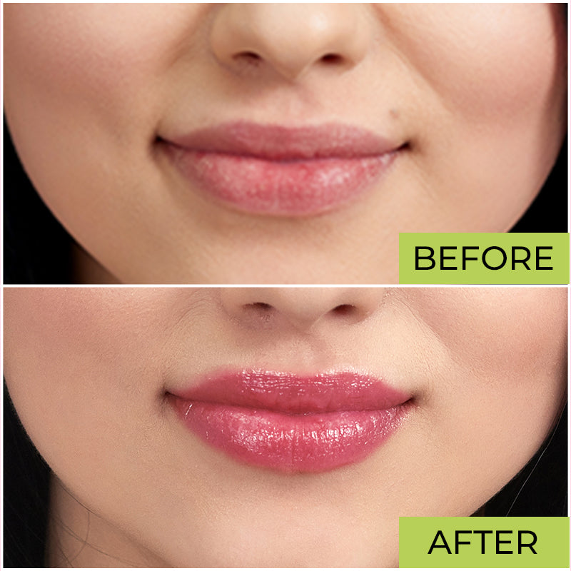 Elitty Lip Balm (6 gm)