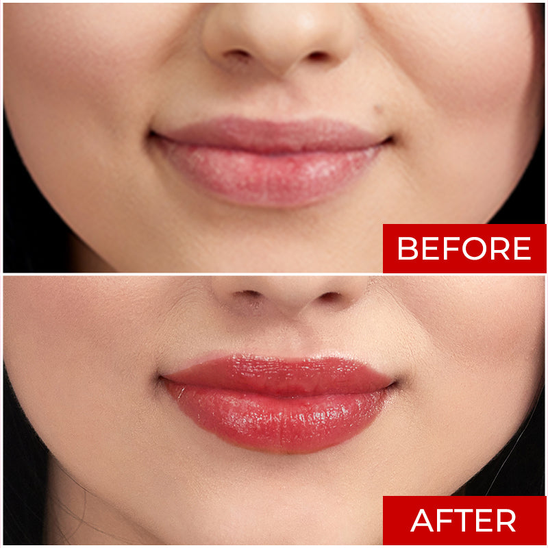 Elitty Lip Balm (6 gm)