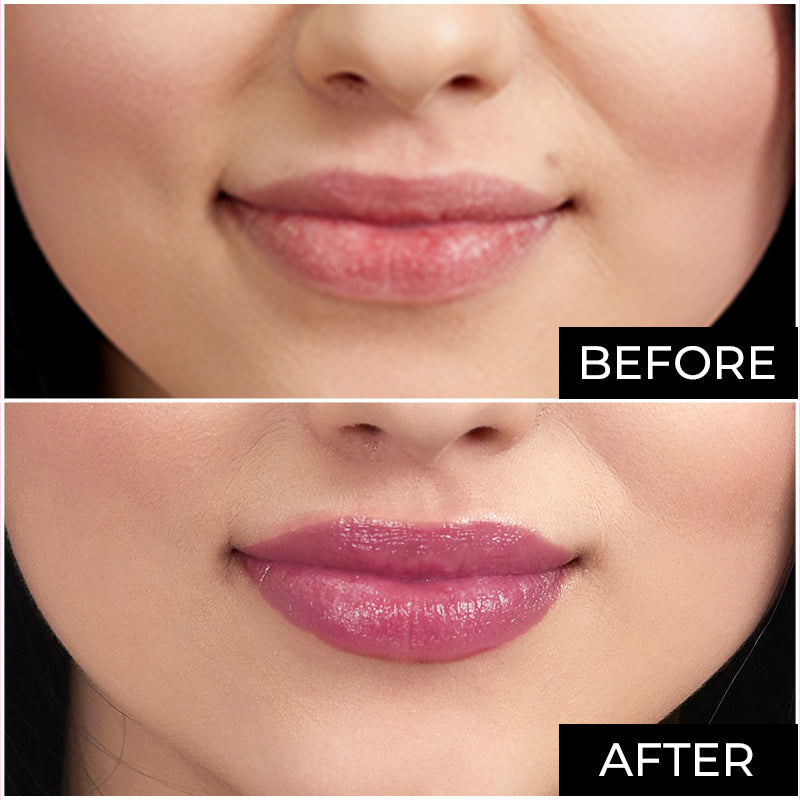 Elitty Lip Balm (6 gm)