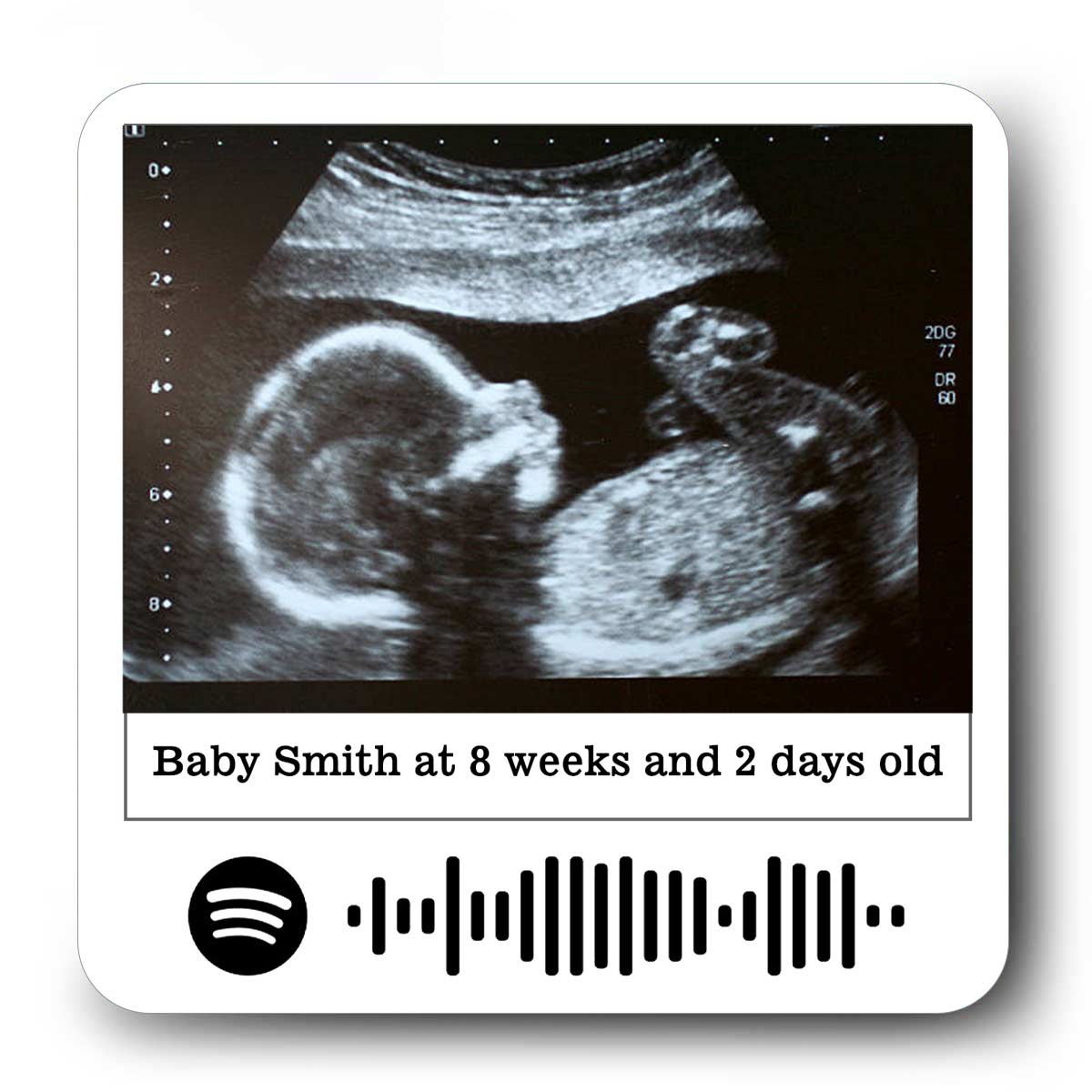 Personalised Baby Ultrasound Fridge Magnet – Custom Keepsake for Parents-to-Be