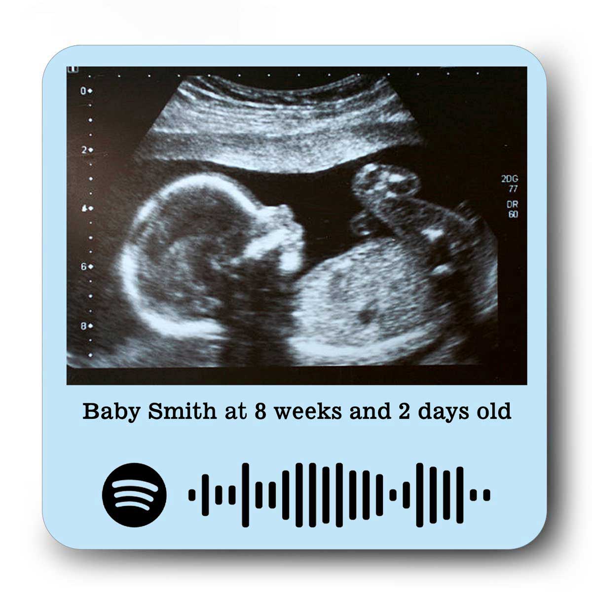 Personalised Baby Ultrasound Fridge Magnet – Custom Keepsake for Parents-to-Be