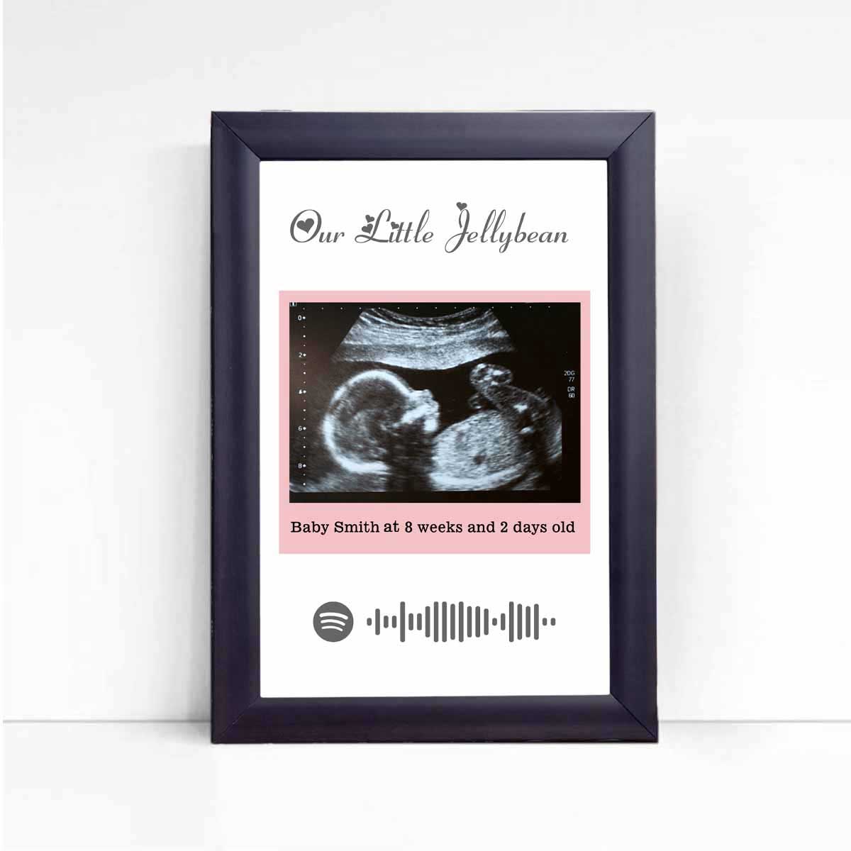Personalised Baby Ultrasound Photo Frame – Our Little Jellybean