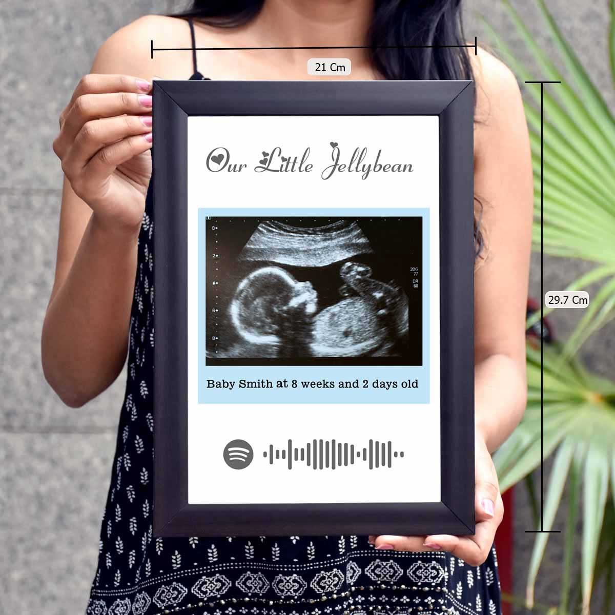 Personalised Baby Ultrasound Photo Frame – Our Little Jellybean