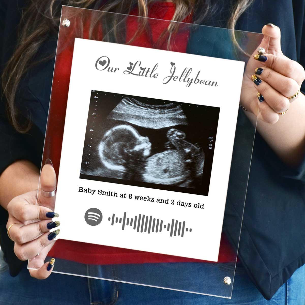 Personalised Baby Ultrasound Photo Frame – Our Little Jellybean