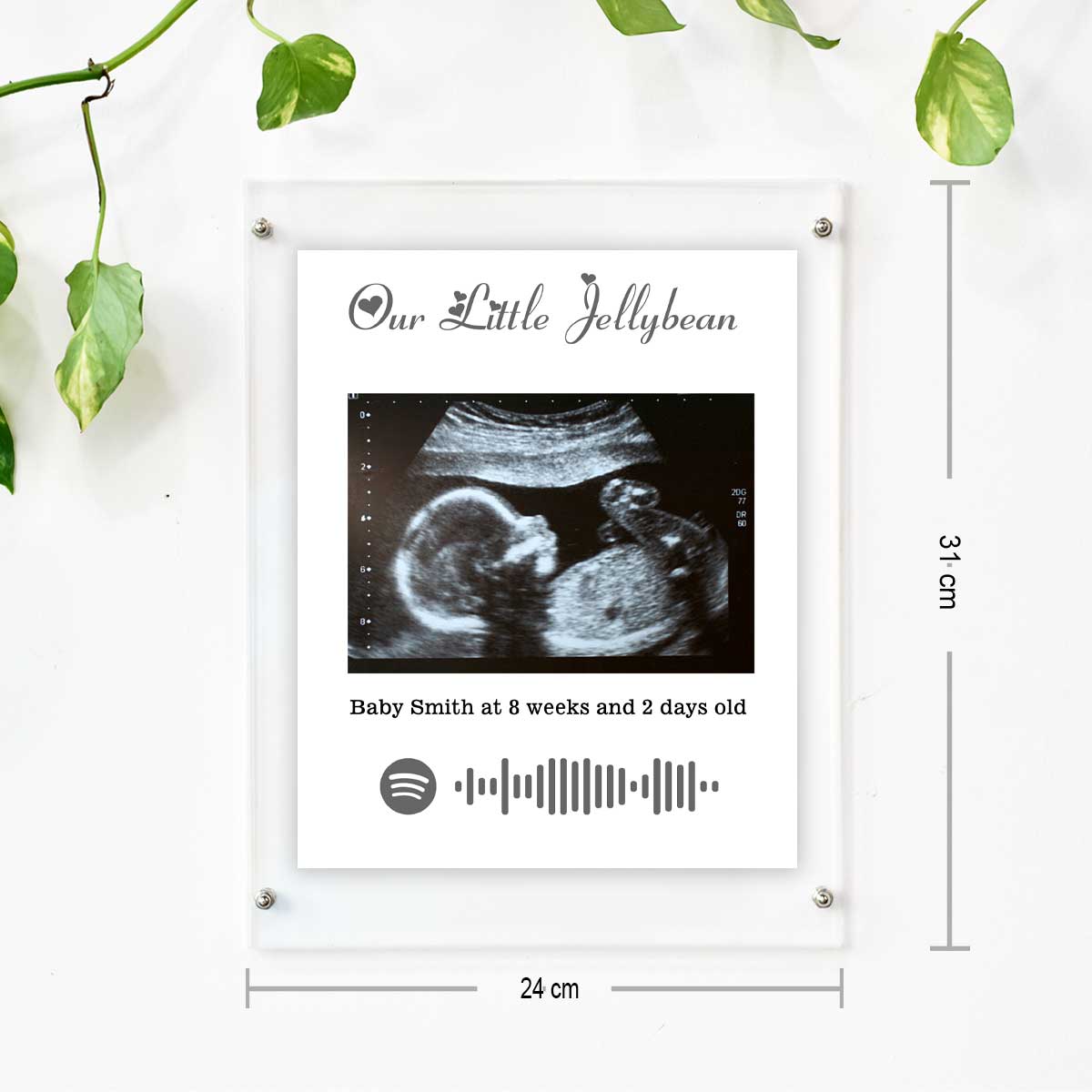 Personalised Baby Ultrasound Photo Frame – Our Little Jellybean