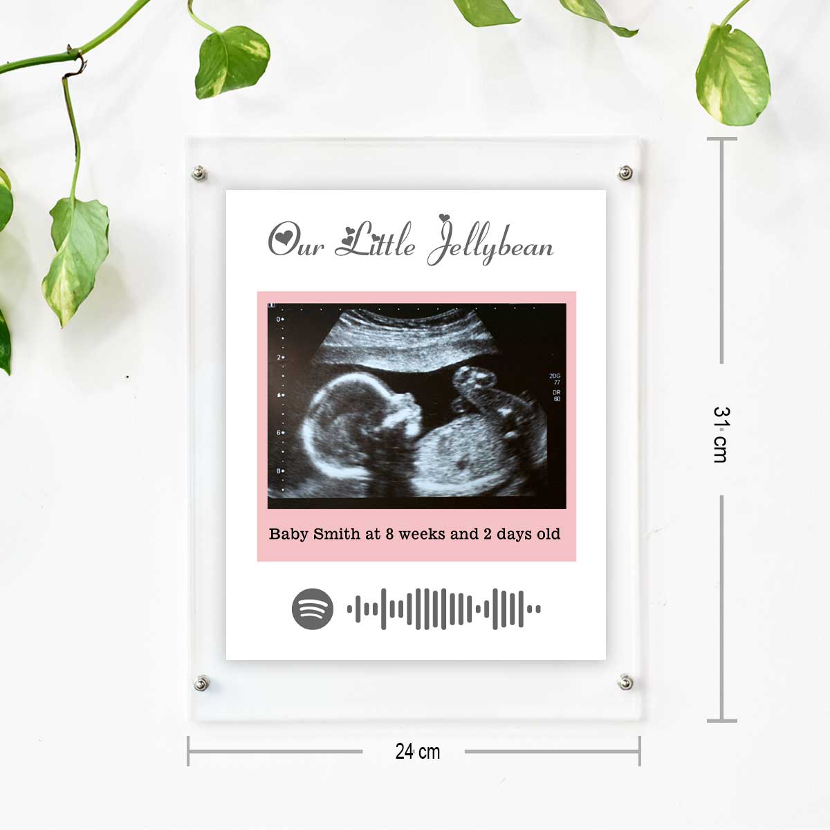 Personalised Baby Ultrasound Photo Frame – Our Little Jellybean