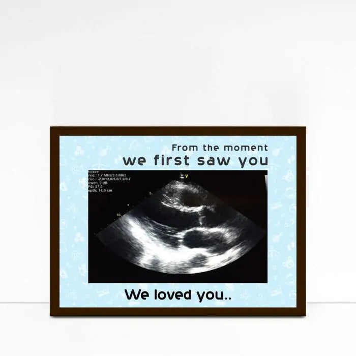 Personalised Love At First Sight Ultrasound Picture Frame-1