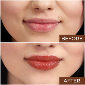 Elitty Lip Balm (6 gm)