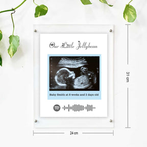 Personalised Baby Ultrasound Photo Frame – Our Little Jellybean