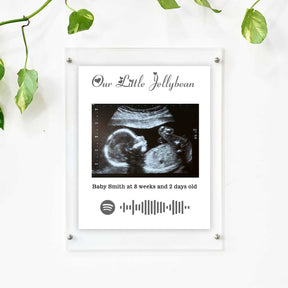 Personalised Baby Ultrasound Photo Frame – Our Little Jellybean