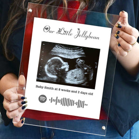 Personalised Baby Ultrasound Photo Frame – Our Little Jellybean