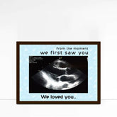 Personalised Love At First Sight Ultrasound Picture Frame
