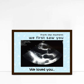 Personalised Love At First Sight Ultrasound Picture Frame-1